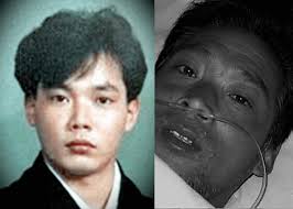 Hisashi Ouchi’s Unbearable Suffering: A Radiation Cautionary Tale